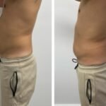 Tratamientos-corporales