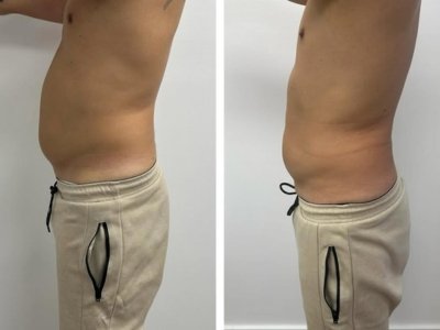 Tratamientos-corporales